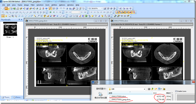 DICOM医学图像处理：开源库mDCM与DCMTK的比较分析（一），JPEG无损压缩DCM图像  