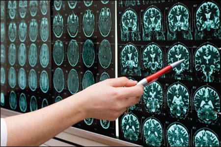 磁共振成像(MRI)的系统图像